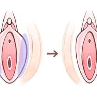  おめこ  Hymen 無修正 