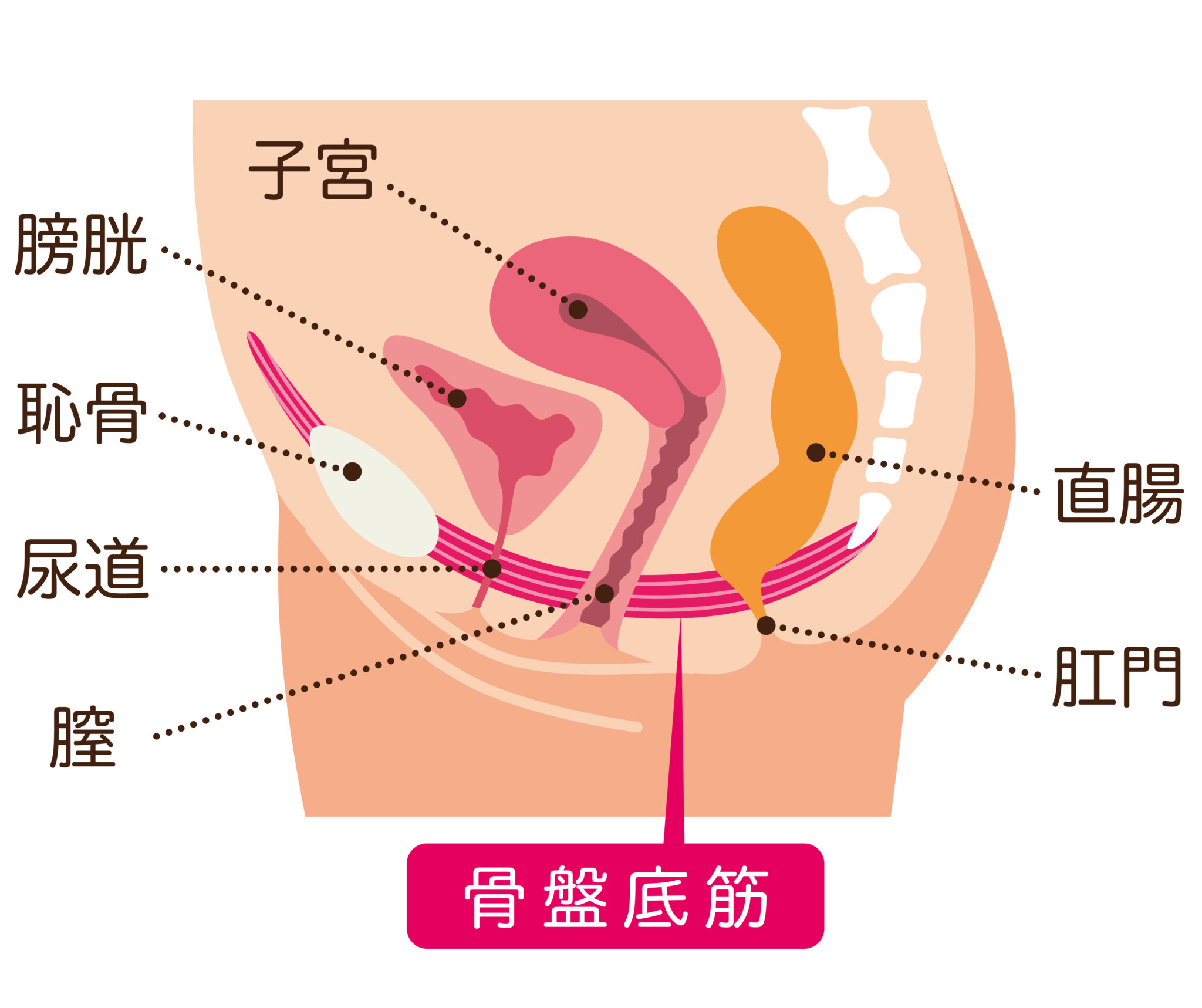 お湯漏れってどんな症状？治療で使用される代表的な機器を紹介 | 腟ペディア（チツペディア）