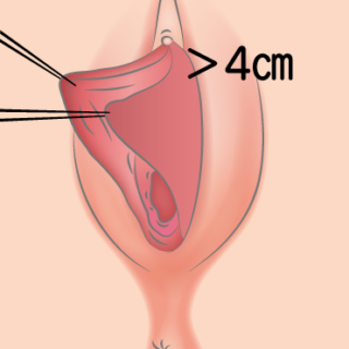 小丁　vagina  無修正 復刻書林