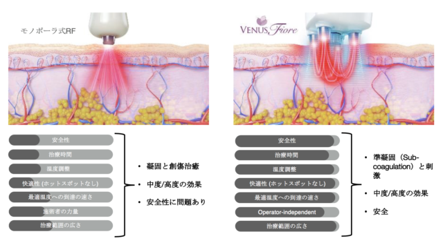 特許技術のマルチポーラ式RFを活用しフェミニンケアに特化 特許技術のマルチポーラ式RFを活用しフェミニンケアに特化