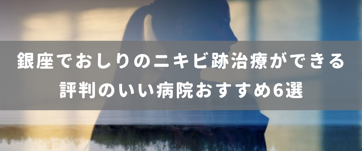 銀座でおしりのニキビ跡治療ができる評判のいい病院おすすめ6選 銀座でおしりのニキビ跡治療ができる評判のいい病院おすすめ6選