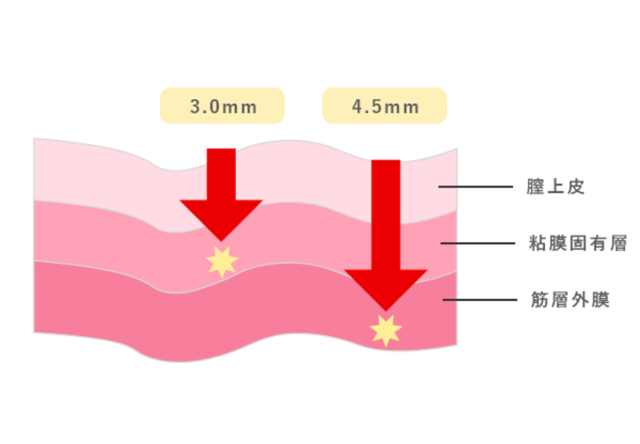 腟圧の平均値は20mmHG！】丹羽咲江医師に腟圧を測定していただきました | 腟ペディア（チツペディア）