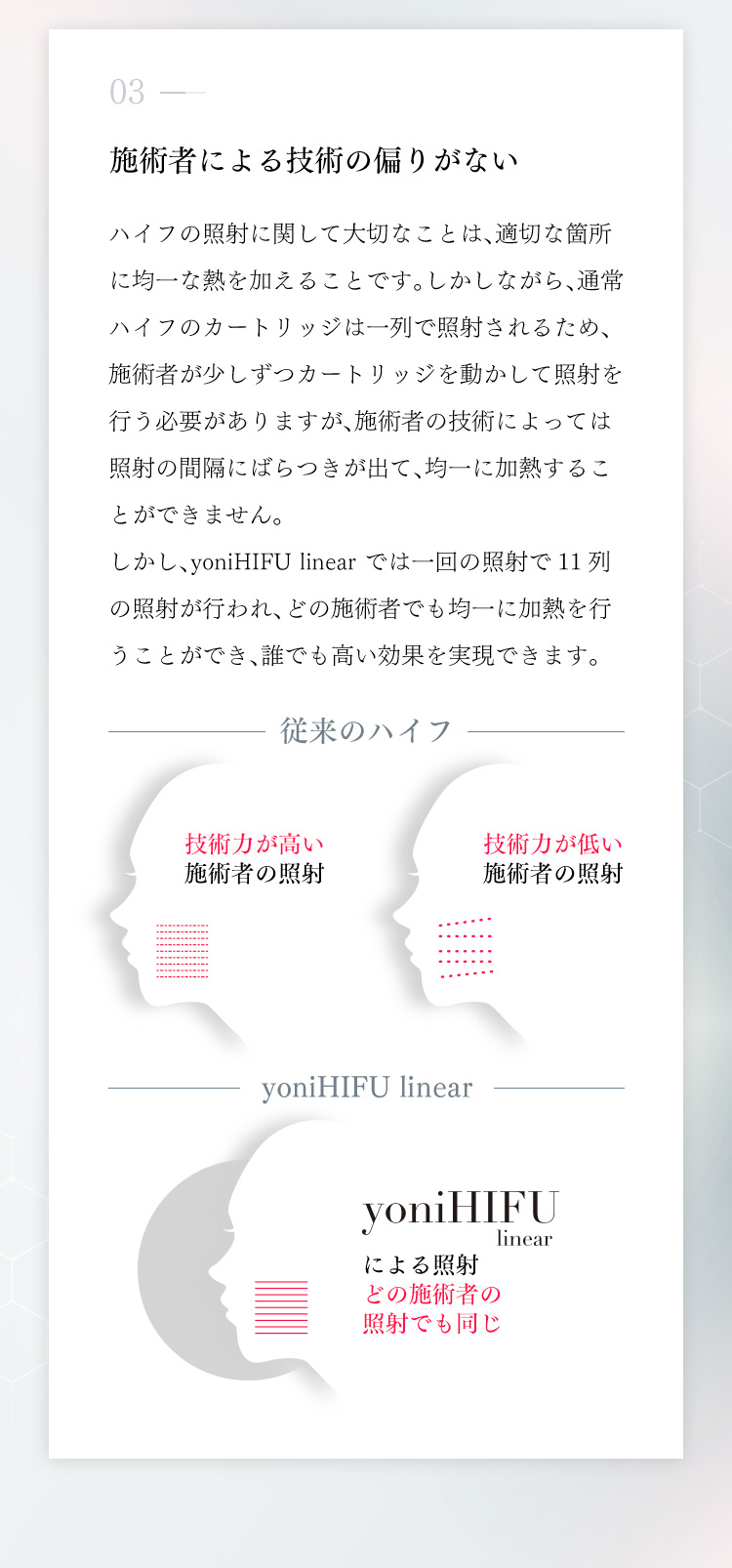 結果を追求した次世代型最新ハイフ